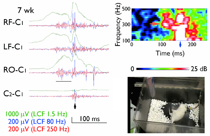 熱性けいれんモデルラット(Scn1a変異)での脳波の高周波解析